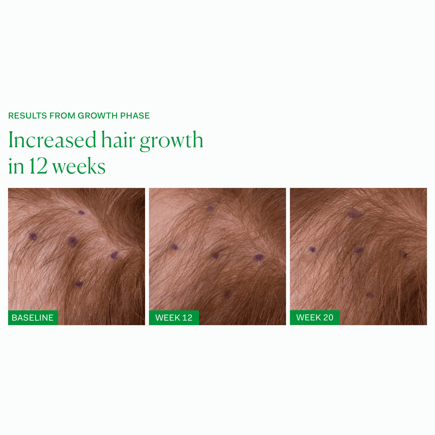 GROWTH PHASE Single The Nue Co.