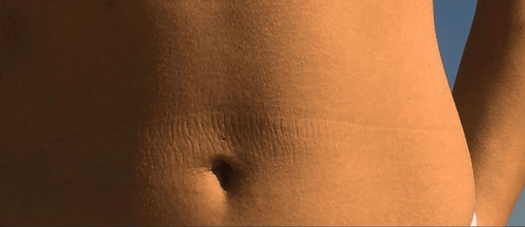 Does Gut Health Affect Performance?