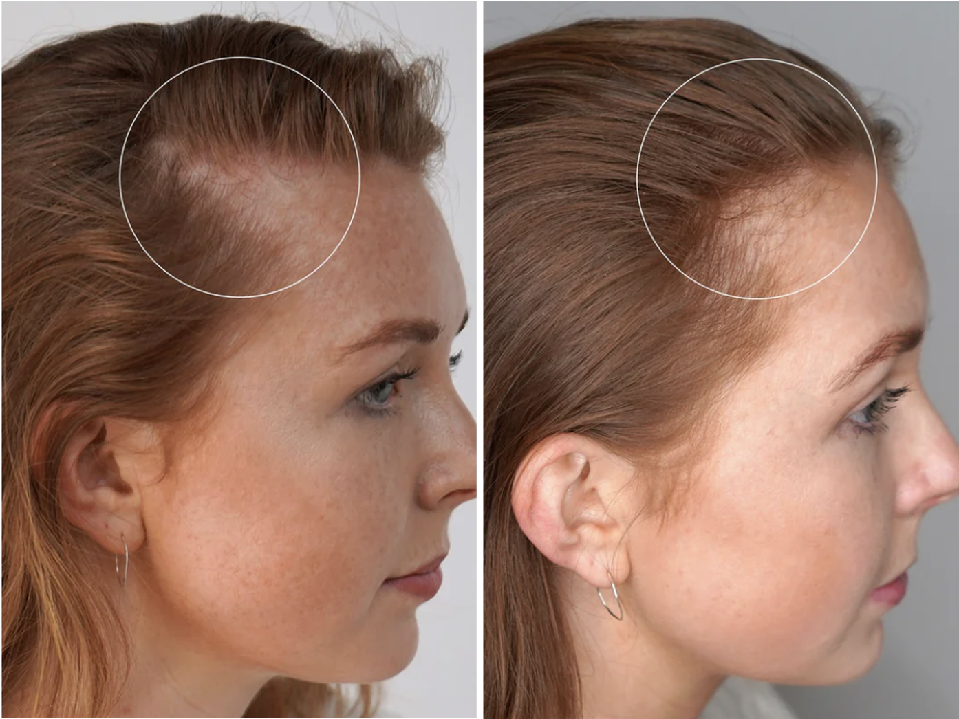 Visibly increased hair growth in 12 weeks.