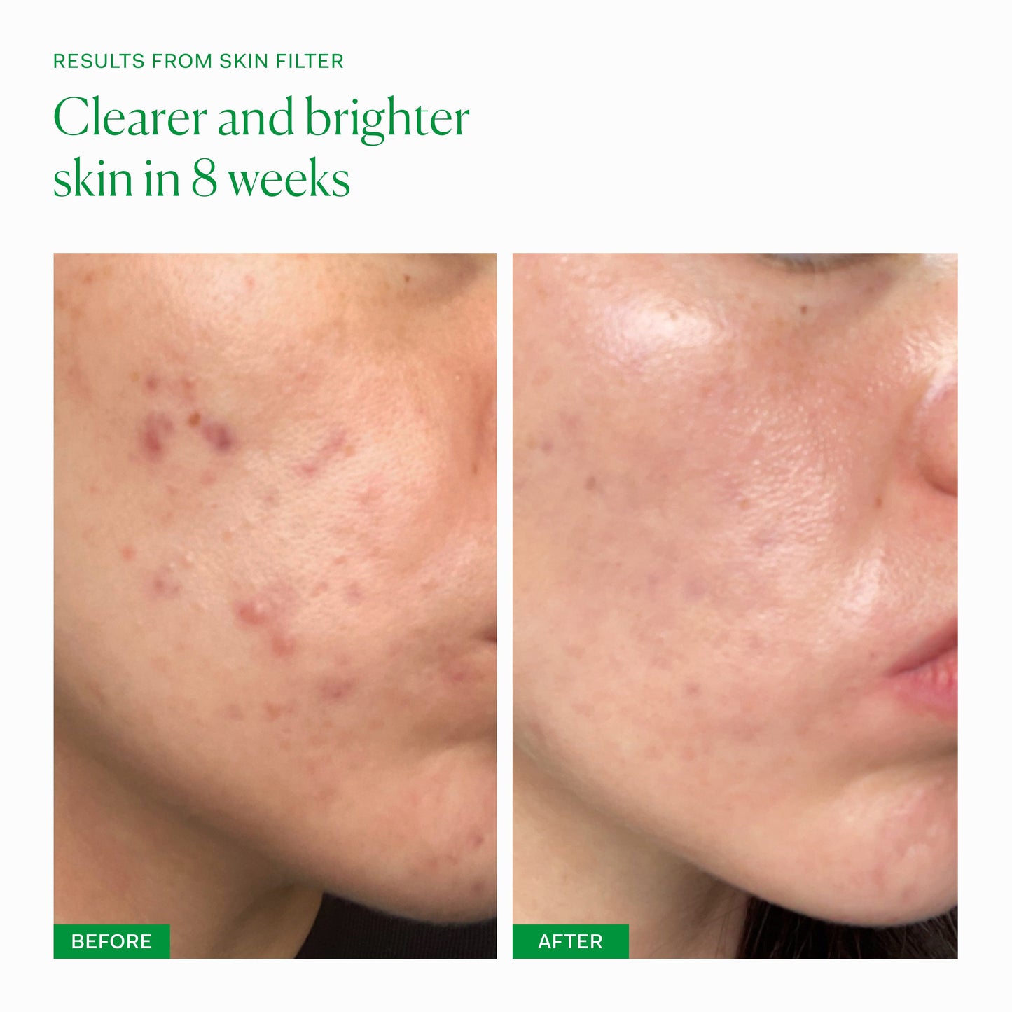 SKIN FILTER single The Nue Co. 