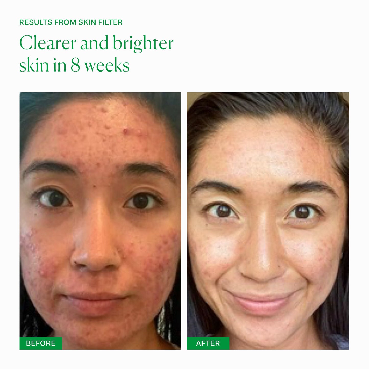SKIN FILTER single The Nue Co. 