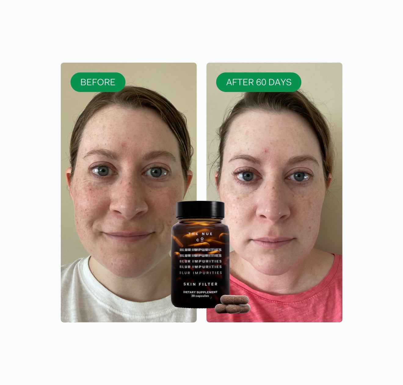 SKIN FILTER 3 Month Subscription Only The Nue Co. 