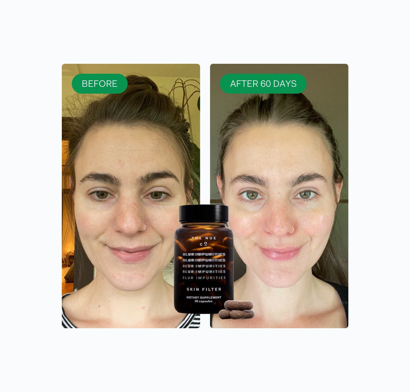 SKIN FILTER 3 Month Subscription Only The Nue Co. 